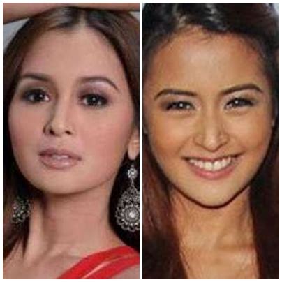 kris bernal|kris bernal before and after.